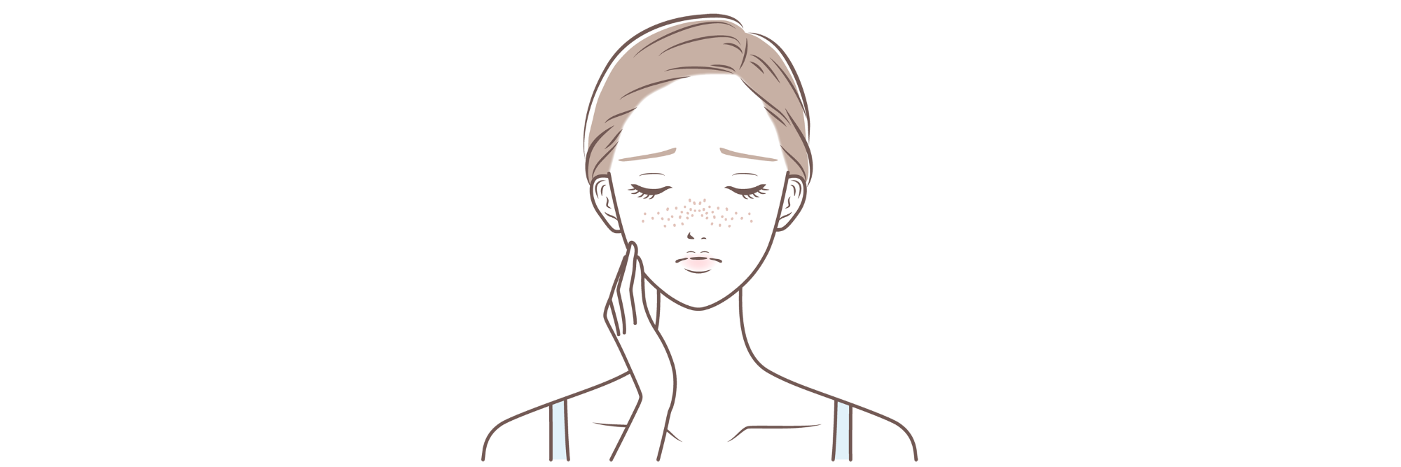 シミ・そばかす